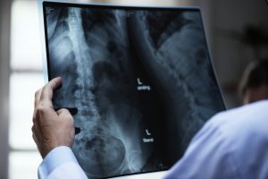 back pain xray why to wear orthotics